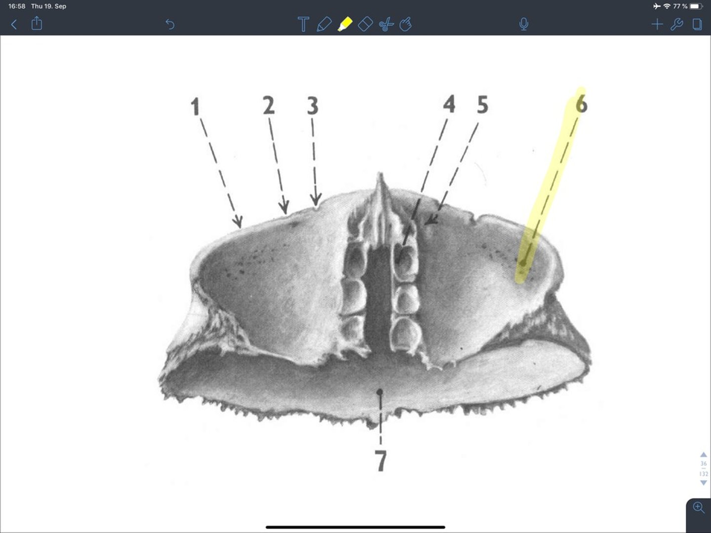 <p>een indieping voor de traanklier, lateraal, is breder maar minder diep dan fovea trochlearis</p>