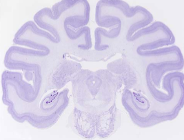 <p>a stain that selectively binds to and highlights acidic components of cells (RNA or DNA or rough ER/ribosomes) – thus, predominantly isolating <strong>cell bodies</strong></p><p>example: Nissl stains, Cresyl violet, DAPI, Propidium Iodine (PI), &amp; Methylene Blue</p>