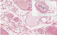 <p>Identify the type of connective tissue</p>