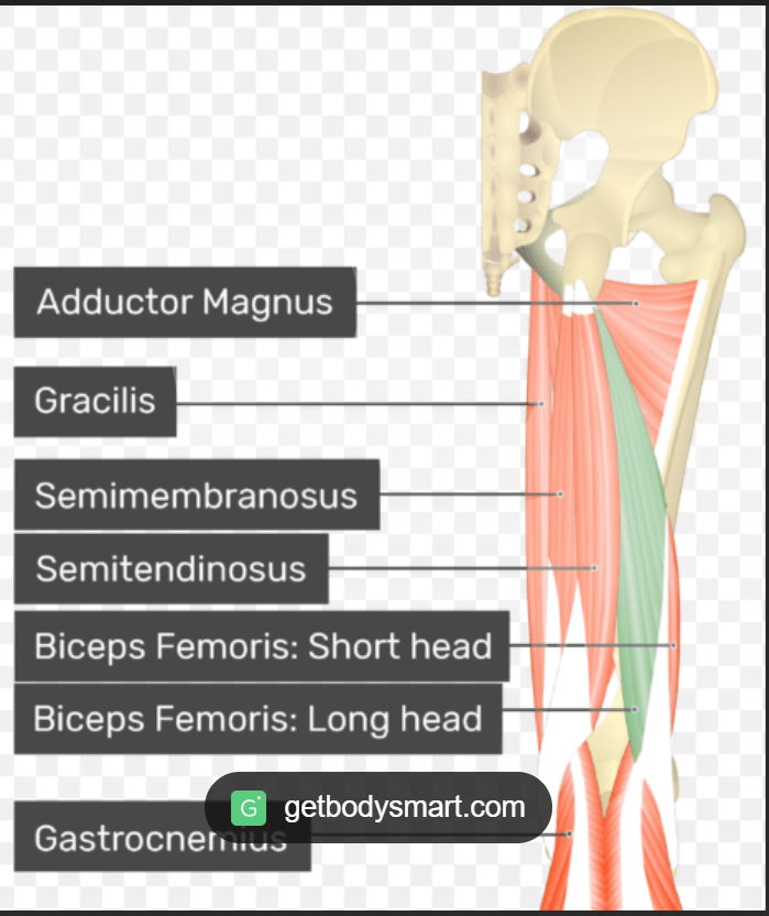<p>Biceps femoris long head (posterior thigh) origin</p>