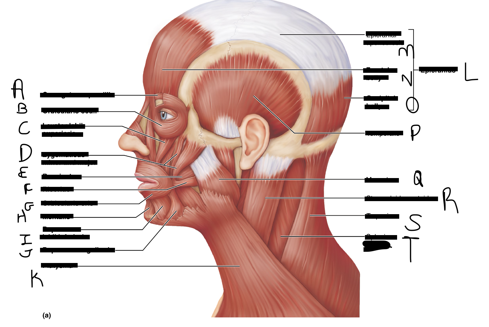<p>Identify structure G?</p>
