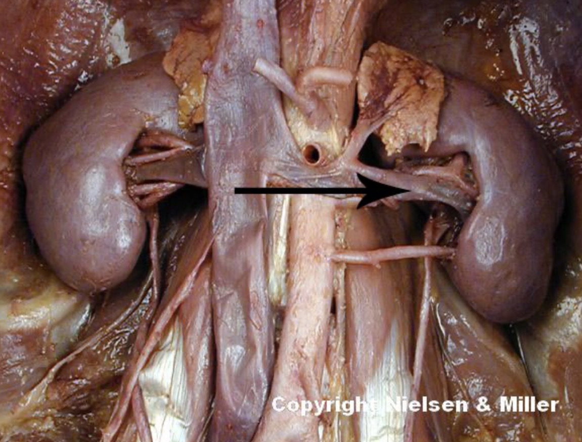 <p>The indicated vessel is the left _. The indicated vessel drains the left _</p>
