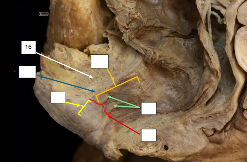 <p>Identify</p><p>Side Question:</p><p>Innervation?</p><p>The deep part of this blends with which structure to form a sling around the anorectal junction?</p><p>Origin?</p><p>Insertion?</p>