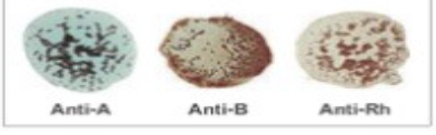 <p>What blood type is this?</p>