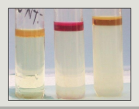 <p>a test that detects tryptophanase, which hydrolyzes tryptophan → indol, pyruvate, and NH<sub>3</sub></p>