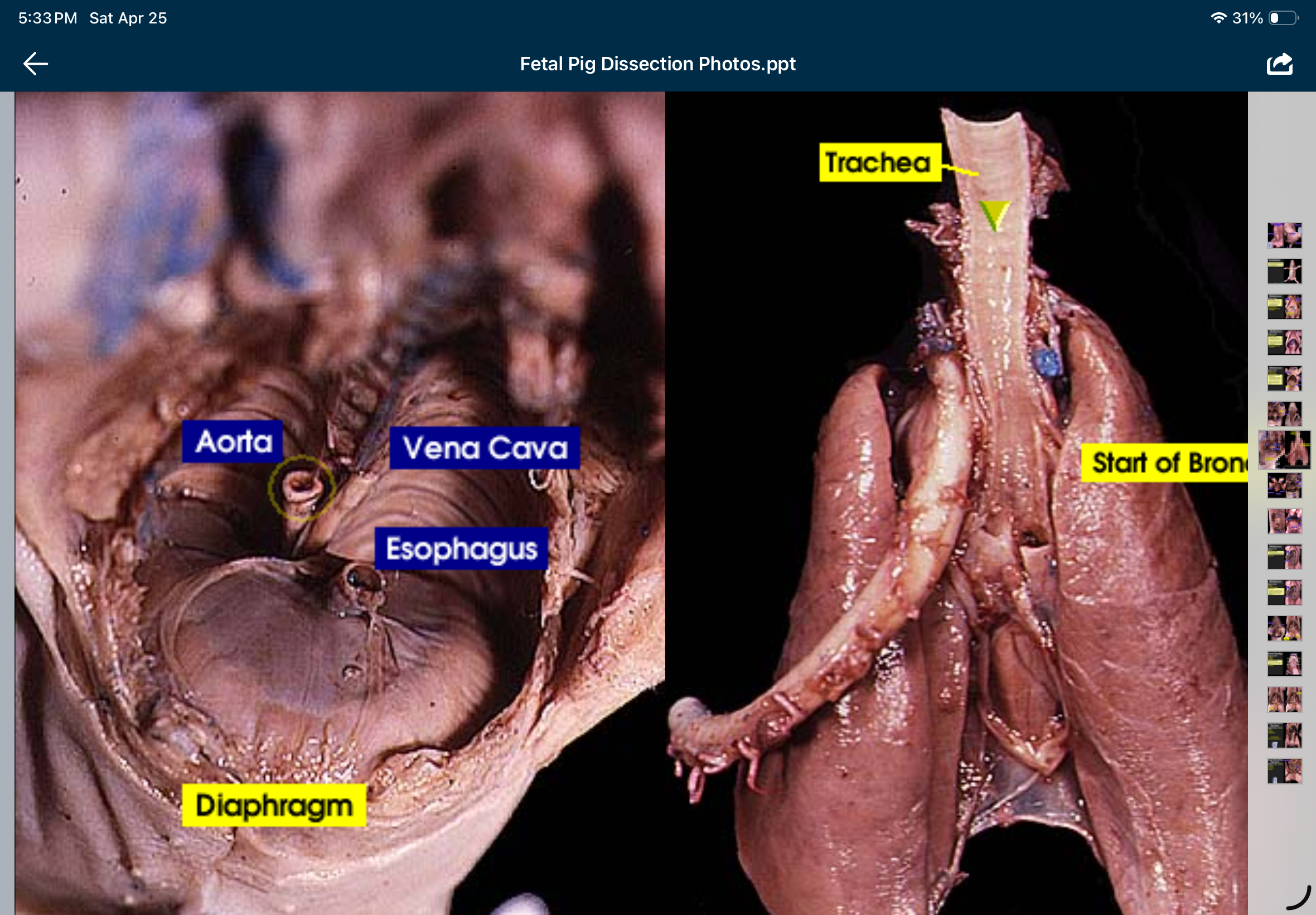 <p>(vena cava comes off heart</p>