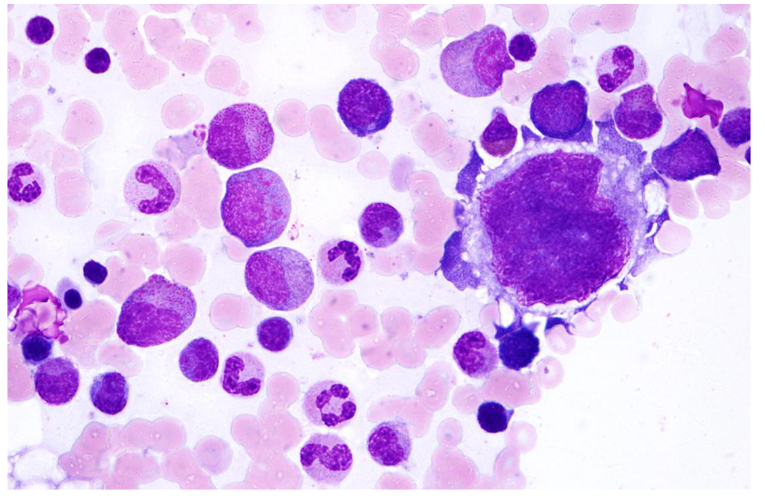 <p>- called megakaryocytes</p><p>- its the big cell on the right (can see that some parts of cytoplasm are coming off - thats how platlets are formed)</p>