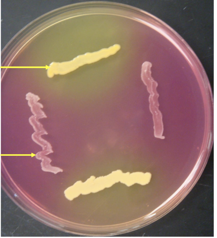 <p>top arrow bacteria?</p>