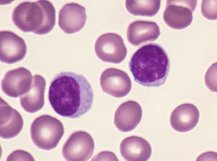 <p>% of WBCs</p><p> • 20-40%</p><p>Location</p><p> • Produced in red bone marrow</p><p> • B lymphocytes (B cells) proliferate in the bone marrow</p><p> • T lymphocytes (T cells) leave the bone marrow and proliferate in the thymus</p><p>Functions</p><p> • B cells produce antibodies (immune protein)</p><p> • There are a variety of T cells that function to destroy virus-infected and cancer cells</p><p> • Both B and T cells produce memory cells - important forfuture exposure to recognized pathogens</p><p>Average Lifespan (in Tissues)</p><p> • Depends on the cell, some live for only a few days and some live for many years</p>