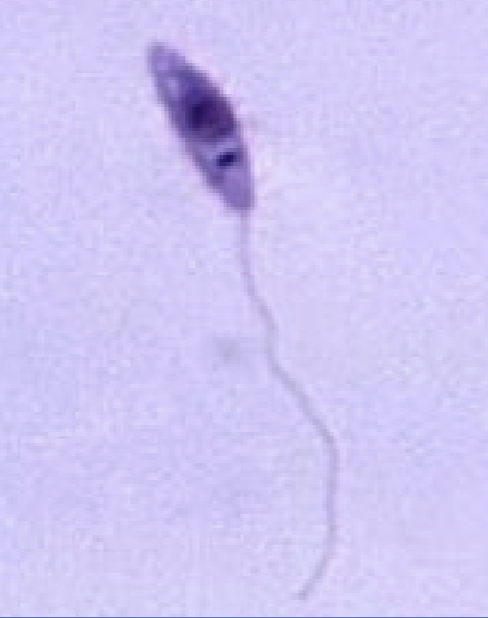 <p>What protist is this?</p>