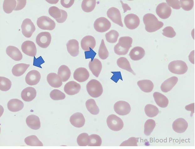 <p>What is this RBC shape?</p>