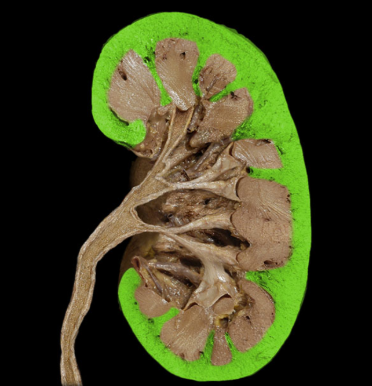 <p>What is the highlighted structure?</p>