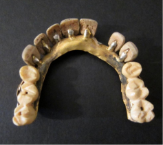 <p>In 1808, an Italian dentist Giuseppangelo Fonzi manufactured <strong>individual </strong>porcelain teeth of improved colour and translucency containing an<strong><em> embedded platinum pin </em></strong>that allowed the teeth to be attached to a <strong>metallic base </strong></p><p>This led to commercial production of ‘Fonzi’ teeth on a mass scale led to the foundation of the S.S.White Company in the United States and Claudius Ash in England</p>