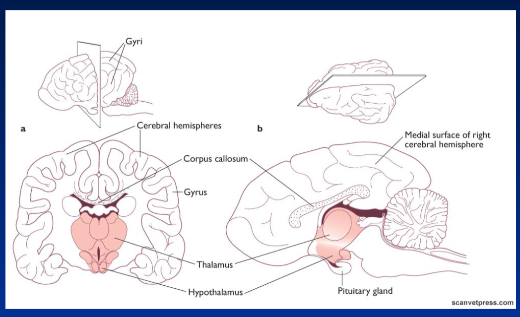 <p><strong>Cerebral Hemispheres</strong><br>  • The brain is divided into <strong>cerebral hemispheres</strong><br>  • <strong>Right cerebral hemisphere</strong> shown from the <strong>medial surface</strong></p><p><strong>Gyri and Gyrus</strong><br>  • <strong>Gyri</strong> → folds or raised areas of the cerebral cortex<br>  • <strong>Gyrus</strong> → singular form of gyri</p><p><strong>Corpus Callosum</strong><br>  • Structure connecting the <strong>two cerebral hemispheres</strong></p><p><strong>Diencephalon Structures</strong><br>  • <strong>Thalamus</strong><br>  • <strong>Hypothalamus</strong><br>  • <strong>Pituitary gland</strong></p>