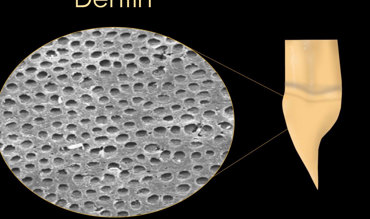 <p>Dentin consists of microscopic channels, called dentinal tubules, which radiate outward through the dentin from</p><p>the pulp to the exterior cementum or enamel border. </p>