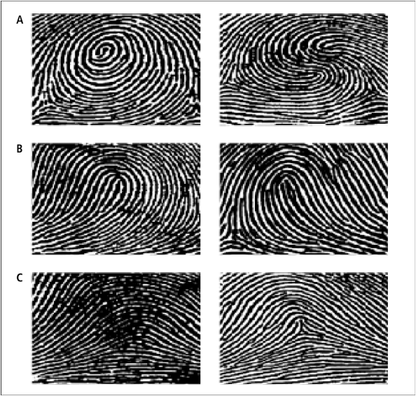 <p><span>The collagen fibers of immature or woven bone are randomly arranged in whorl-like layers, similar to your fingerprints.</span></p>