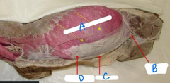 <p>A</p>