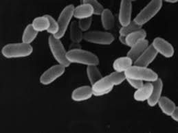 <p>examples of prokaryotes</p>