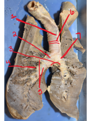 <p>What is structure #2</p>