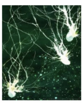 <p>Purkinje Neuron : Function : Coordinates movement and balance by transmitting impulses in the cerebellum.</p>