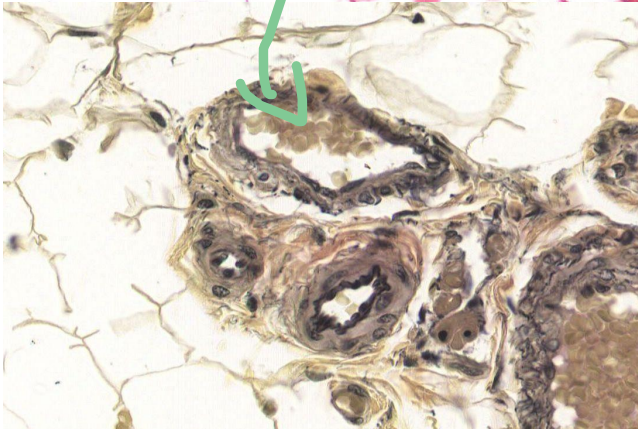 <p>Identify the vessel indicated by the arrow?</p>