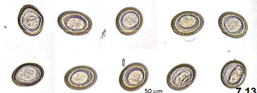 <p>Keywords for Taenids (Taenia Pisiforms - Dog , Taenia Saginata - Beef, Taenia Solium- Pig)</p>