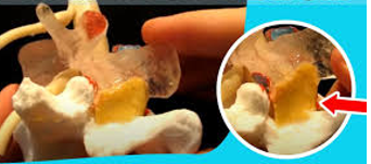 <ul><li><p><strong>Broad, pale,</strong><span style="color: yellow;"><strong> yellow elastic </strong></span><strong>fibrous tissue</strong></p></li><li><p><strong>Extends from lamina above to the lamina below</strong></p></li><li><p><span style="font-family: "Century Gothic";">Forms the <strong>posterior wall </strong>of the vertebral canal</span></p></li><li><p><span style="color: red;"><strong>Limiting abrupt flexion</strong></span><strong> </strong>of the vertebral column, prevents injury to the IV discs</p></li><li><p><span style="color: red;"><strong>Preserve normal curvature</strong></span>, <span style="color: red;"><strong>Assist with straightening</strong></span> after flexing (standing up)</p></li><li><p><span style="font-family: "Century Gothic";">Cervical Region- thin</span></p></li><li><p><span style="font-family: "Century Gothic";">Thoracic Region Thicker</span></p></li><li><p><span style="font-family: "Century Gothic";">Lumbar- Thickest</span></p></li></ul><p></p>
