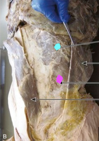<p>Origin of the muscle with the blue dot </p>