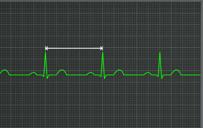 <p>What interval is this</p>