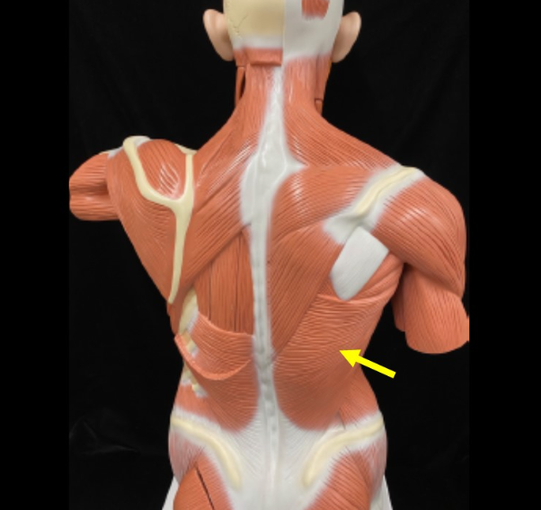 <p>Name the muscle</p>