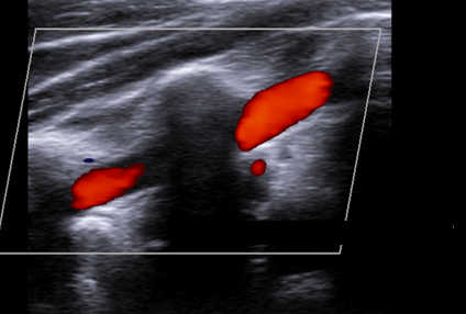 <p>What vessel is being shown in this image?</p>