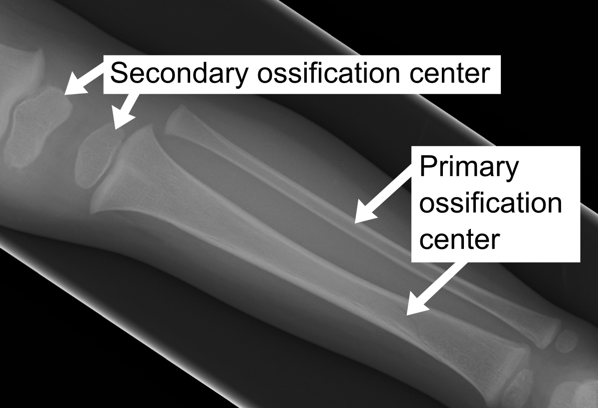 <p>location in the membrane where ossification begins</p>