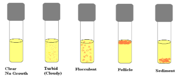 <p><span style="background-color: transparent;">characteristic growth patterns</span></p><ul><li><p>Pellicle</p></li><li><p>Sediment</p></li><li><p>Uniform fine turbidity</p></li><li><p>Flocculent</p></li></ul><p></p>