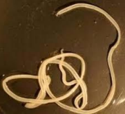<p>What is a <strong>solution </strong>that <strong>reduces </strong>the <strong>rate</strong> of <strong>Guinea worm infections</strong> contracted through<strong> drinking water?</strong></p>