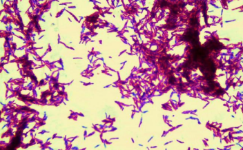 <p>Bacteria species: </p><p>Acid-fast + / - : </p><p></p>