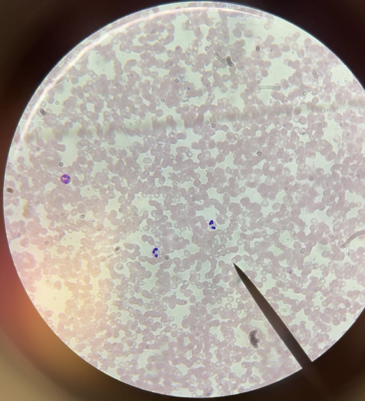 <p>tissue</p>