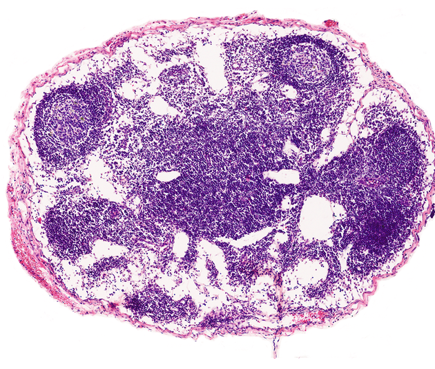 term image