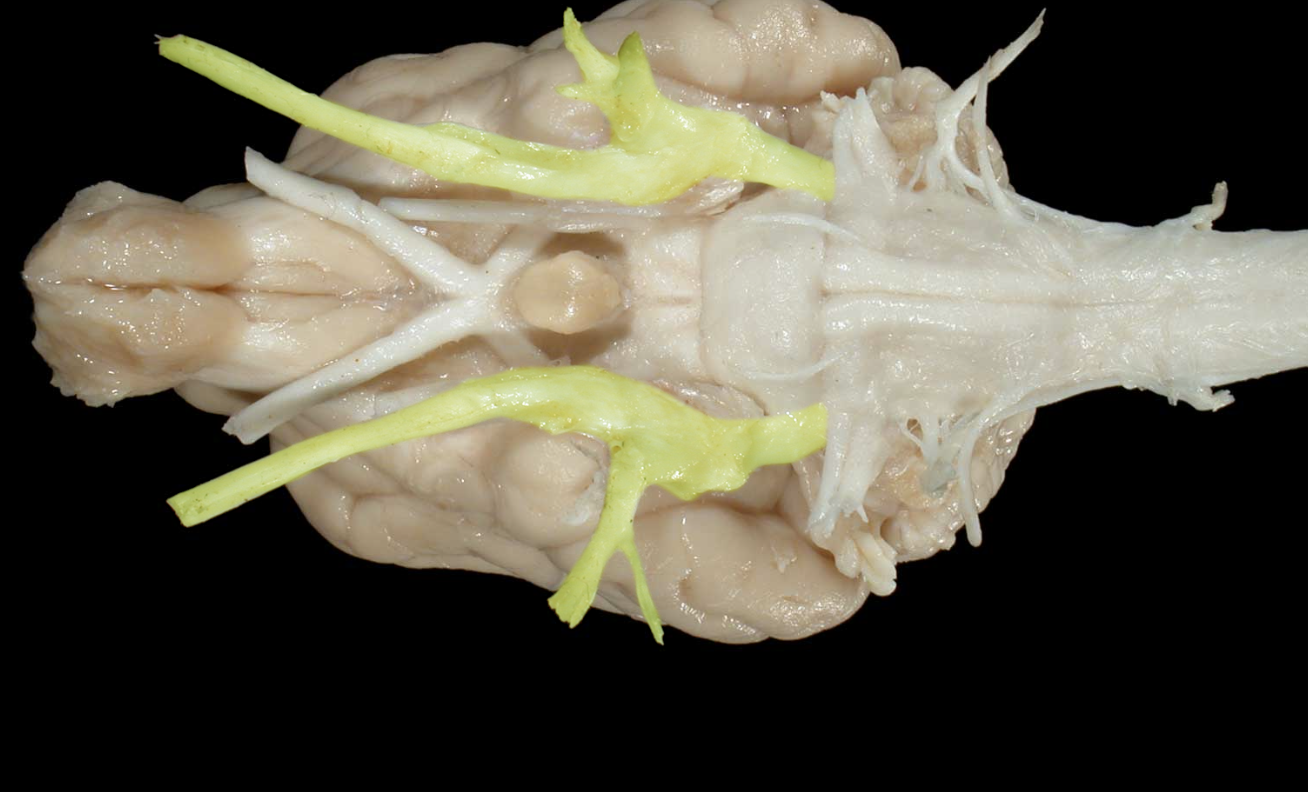 <p>what nerve is this</p>