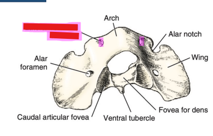 <p>Q: The …… perforates the craniodorsal part of the vertebral arch of the atlas for the 1st cervical spinal nerve and vertebral artery. </p><p>A. Lateral vertebral foramen </p><p>B. Transverse foramen </p><p>C. Alar notch </p><p>D. Pelvic sacral foramen</p>