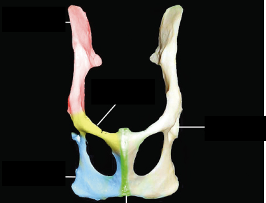 <p>Name these portions of the pelvic girdle</p>