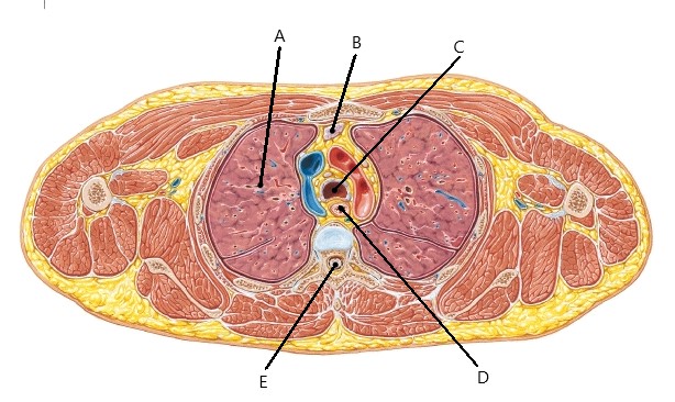 <p>Identify A-E (Thorax)</p>