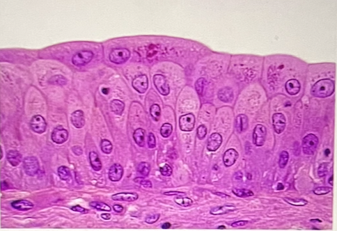 <p>where is this epithelial type located?</p><p>a. urinary bladder</p><p>b. thick skin</p><p>c. esophagus</p><p>d. trachea</p><p>e. oral cavity</p>