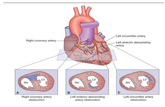 <ul><li><p>right coronary artery</p></li><li><p>left anterior descending artery</p></li><li><p>left circumflex artery</p></li></ul><p>*knowing helps to determine what clinical manifestations we might see</p><p></p>
