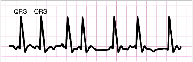 <p>What type of graph is this?</p>