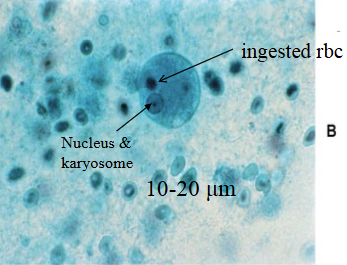 <ul><li><p><mark data-color="#b0b600" style="background-color: rgb(176, 182, 0); color: inherit;">INGESTED RBCs (larger dark dot not to be confused with the nucleus)</mark></p></li><li><p><mark data-color="#b0b600" style="background-color: rgb(176, 182, 0); color: inherit;">SMALL CENTERED KARYOSOME </mark></p></li><li><p>15-25um average size</p></li><li><p>Finely granular cytoplasm</p></li></ul><p>REMEMBER THAT TROPHOZOITE’S ARE IRREGULARLY SHAPED</p><p></p>
