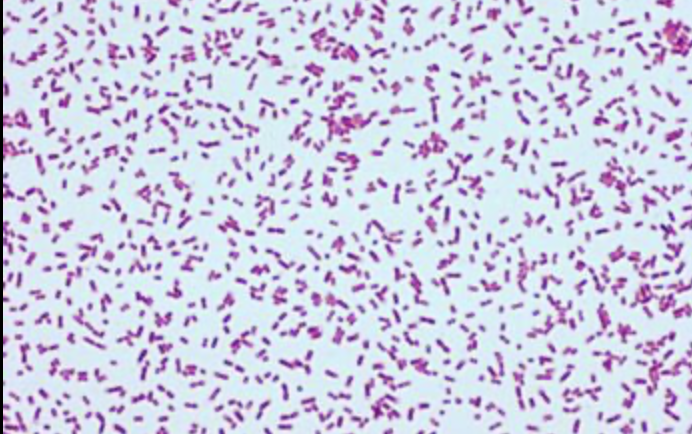 <ul><li><p>ATCC # - 8750 </p></li><li><p>Medium - tryptic soy agar (TSA)</p></li><li><p>Incubation - 37 degrees celsius </p></li><li><p>Gram Negative</p></li><li><p>Shape - Rod</p></li><li><p>Oxygen - Aerobic</p></li><li><p>Disease - Opportunistic </p></li><li><p>Key tests - Oxidase+</p></li><li><p>Appearance - Non-pigmented, grayish white colonies </p></li><li><p>Found - Soil, water, intestinal tract of humans/animals </p></li></ul><p></p>