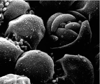 <p><span>Dogs (C. canis*), Pigs (C. suis*), Calves &amp; Lambs (<u>C. parvum</u>*), Birds (C. meleagridis), <br>Humans (<u>C. hominis </u>&amp; C. cuniculus, and *) - <u>most important</u>.</span></p>