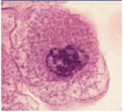 <p>chromatin condenses, forming barlike chromosomes; each duplicated chromosome consists of two identical threads called sister chromatids, held together at the centromere; as the chromosomes appear, the nucleoli disappear, and the two centrosomes separate from one another; the centrosomes act as focal points for growth of a microtubule assembly called the mitotic spindle. As the microtubules lengthen, they propel the centrosomes toward opposite poles of the cell; microtubule arrays called asters extend from the centrosome matrix</p>
