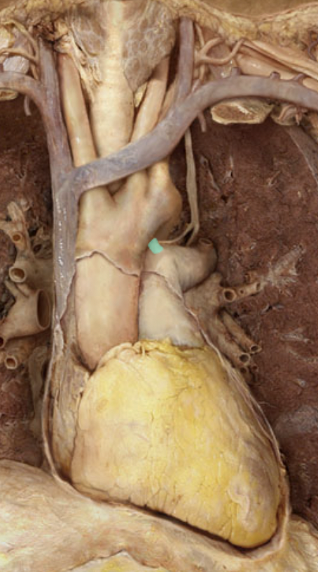 <p>Identify the feature of the heart</p>