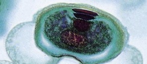 <p>Identify the stage of the pollen grain.</p>